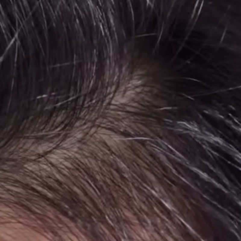 Grey strands along a woman's parting, before use